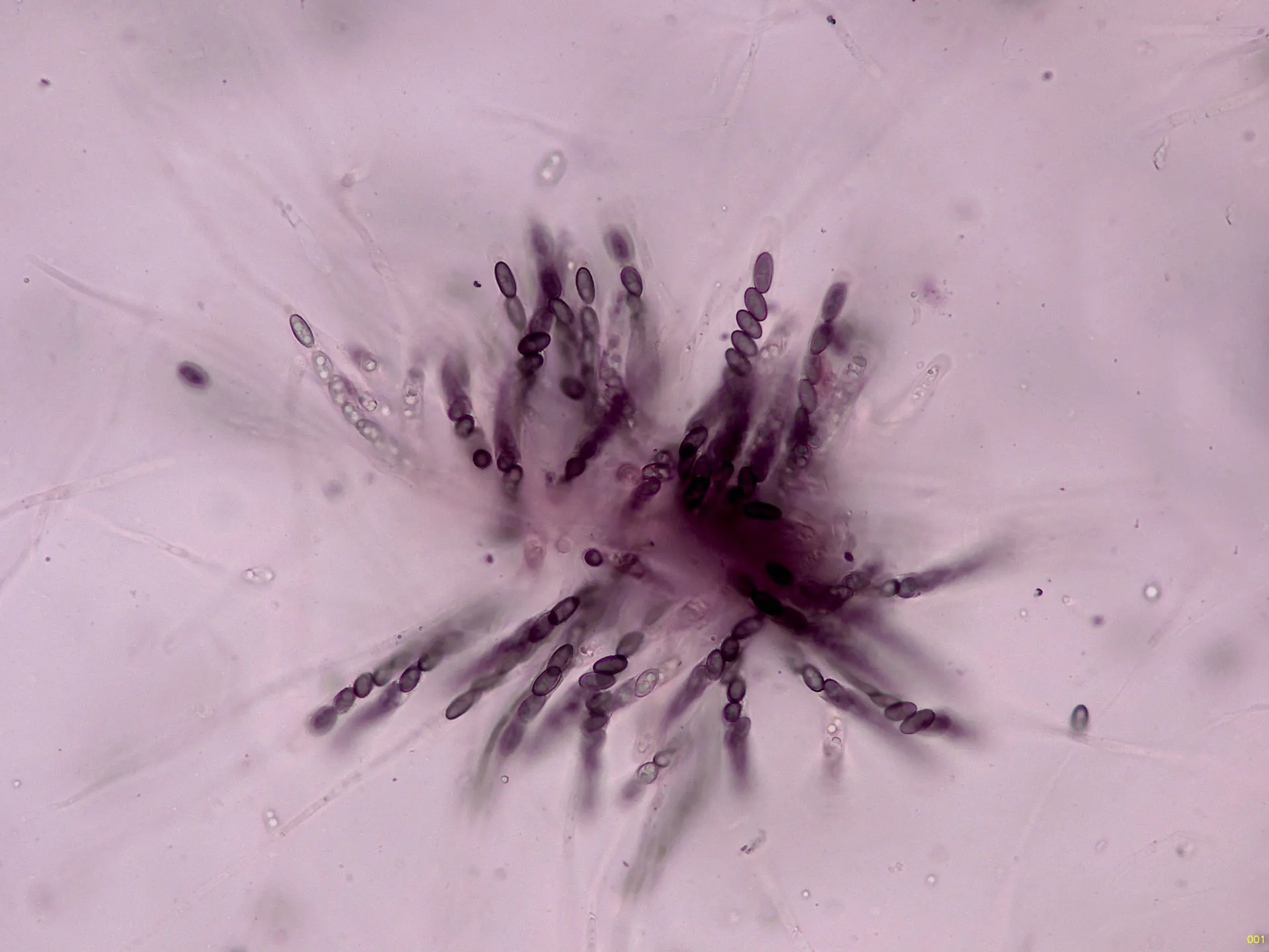 Microscopía de Nemania maritima - 11 - Ascos x 400-001